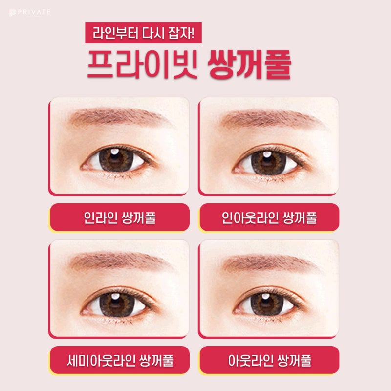 눈성형전후가 좋은 프라이빗성형외과 사진 5
