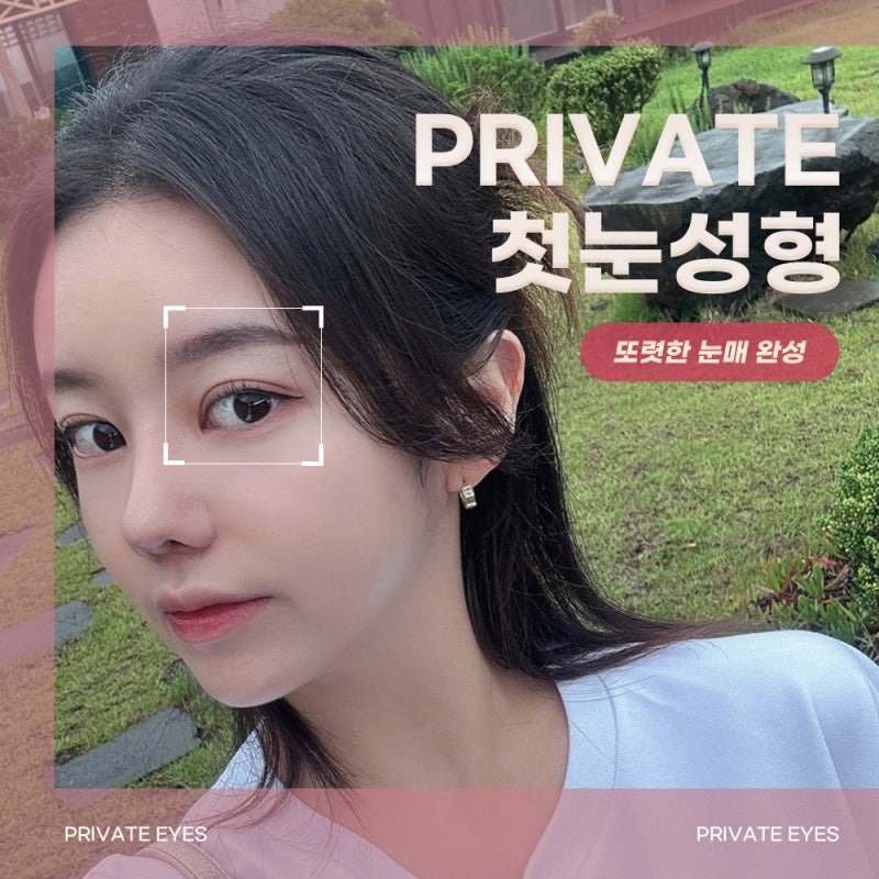 눈성형전후가 좋은 프라이빗성형외과 사진 2