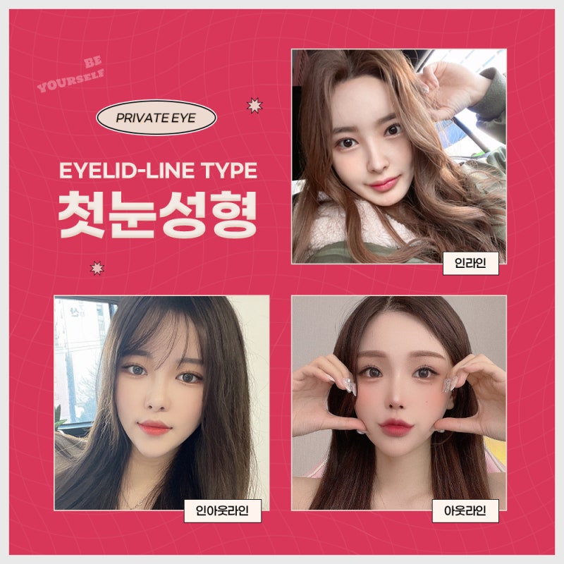 눈성형전후가 좋은 프라이빗성형외과 사진 4