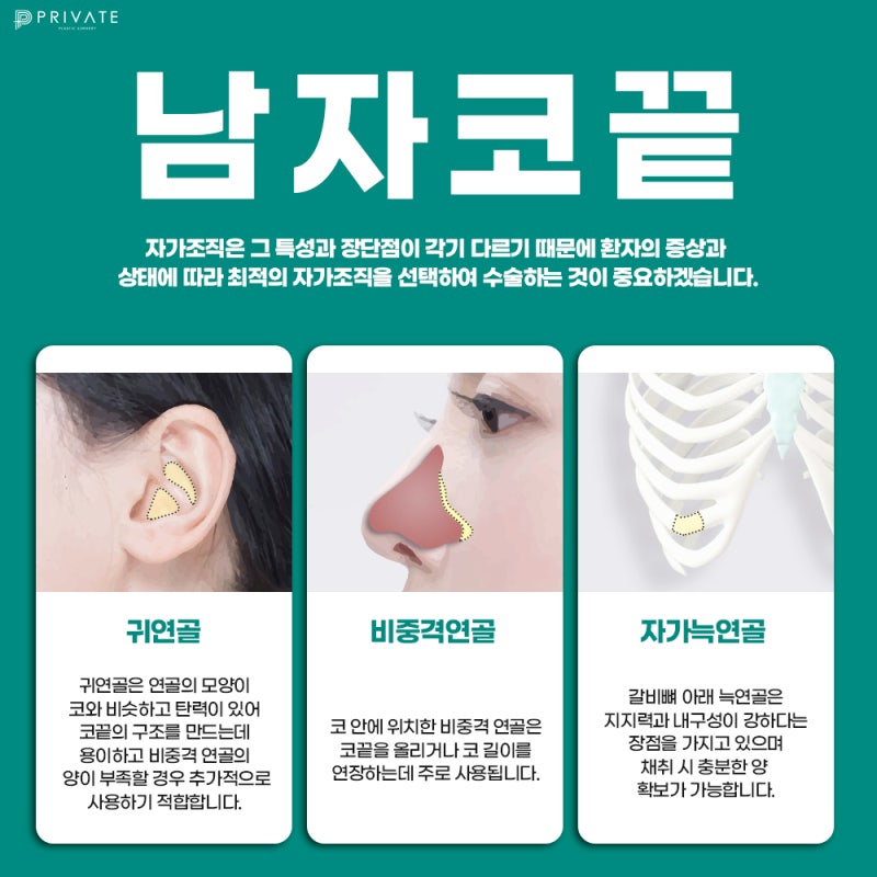 무보형물 코끝수술 신사역 프라이빗성형외과 사진 4