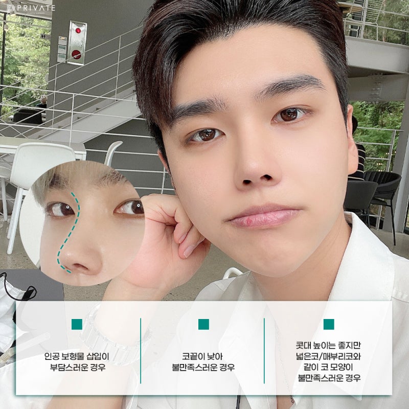 무보형물 코끝수술 신사역 프라이빗성형외과 사진 5