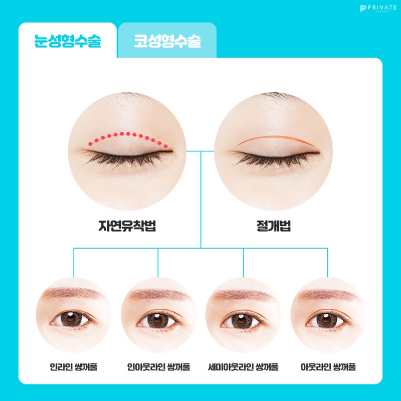 Acara Bedah Plastik untuk Pelajar Ujian di Sini, Private Plastic Surgery 사진 4