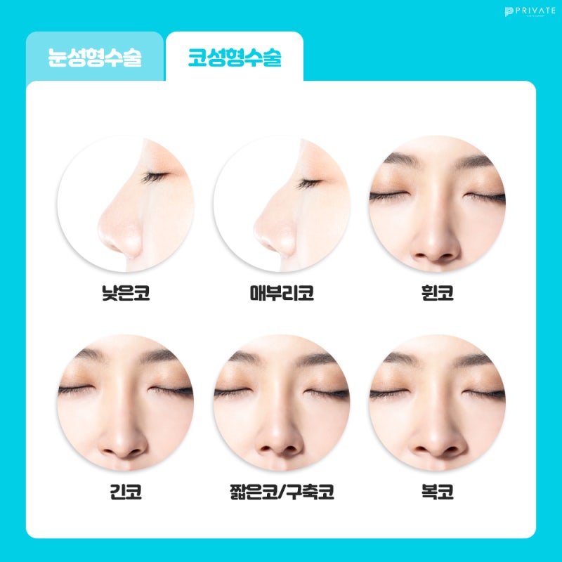 Acara Bedah Plastik untuk Pelajar Ujian di Sini, Private Plastic Surgery 사진 5