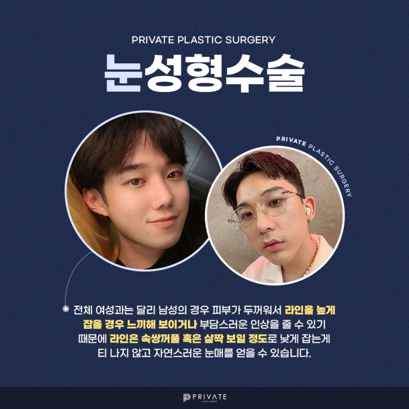男士双眼皮手术做得好的地方,Private整形外科