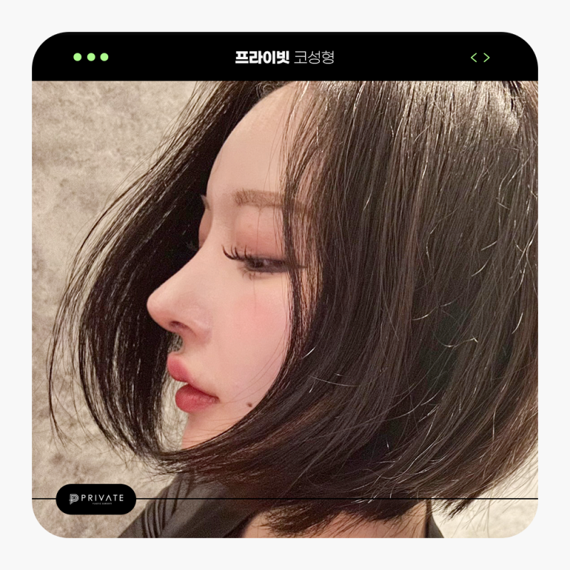 성형리얼모델모집 프라이빗성형외과