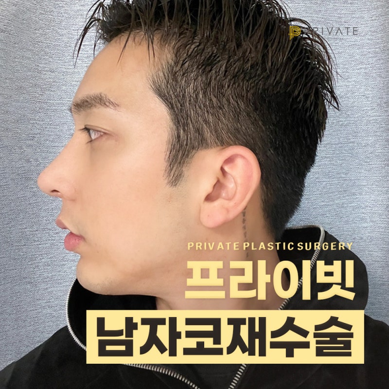 남자 코 재수술 잘하는곳, 신사 프라이빗성형외과