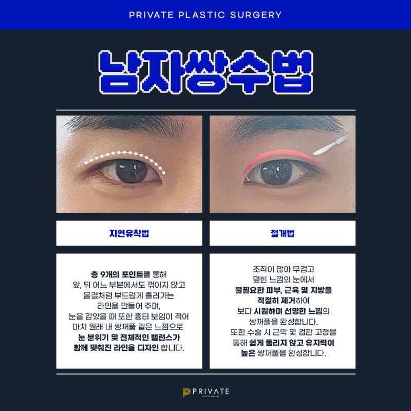 남자 쌍수 병원은 신사 프라이빗성형외과 사진 4