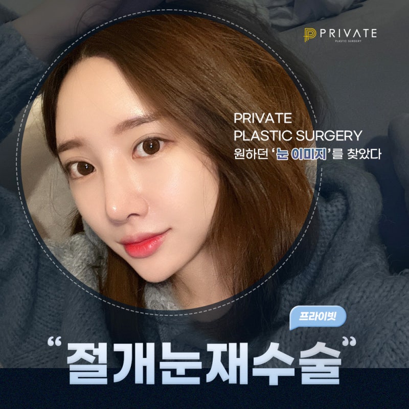 쌍수 절개 재수술은 신사 프라이빗성형외과 사진 2