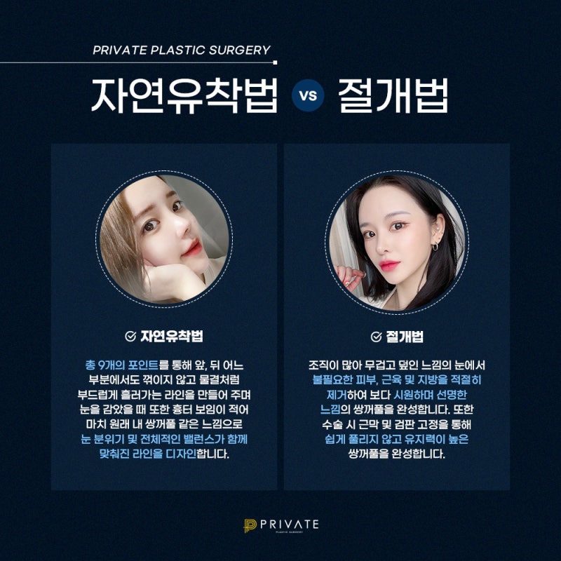 쌍수 절개 재수술은 신사 프라이빗성형외과 사진 4