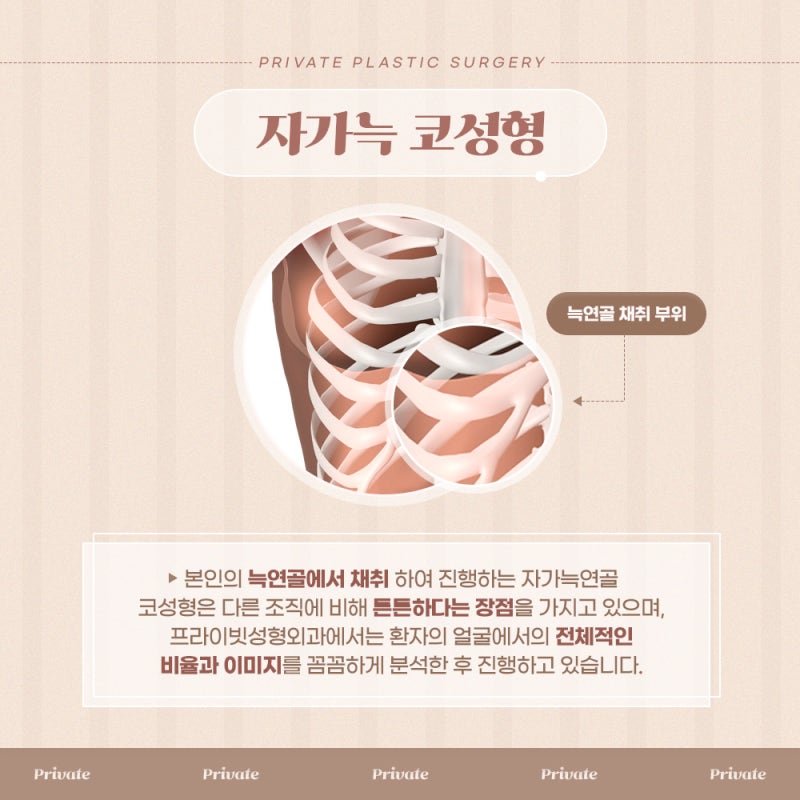 자가늑코성형잘하는곳은 프라이빗성형외과