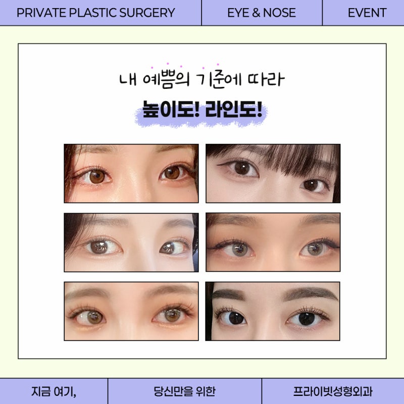 쌍수 잘하는 병원은 프라이빗성형외과 사진 6