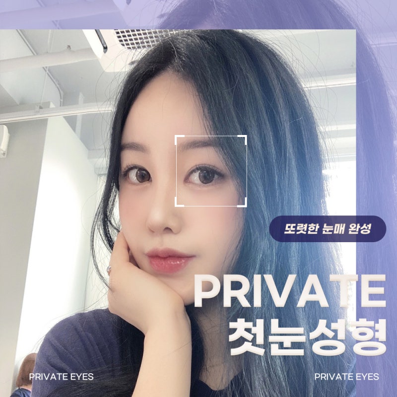 쌍수 잘하는 병원은 프라이빗성형외과 사진 2
