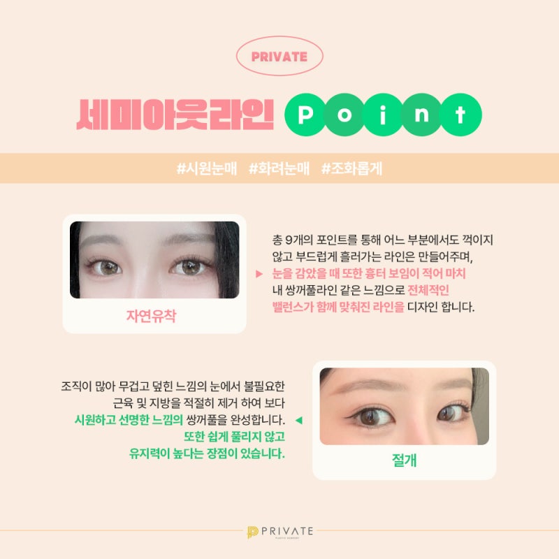 세미아웃라인 쌍꺼풀수술은 프라이빗성형외과