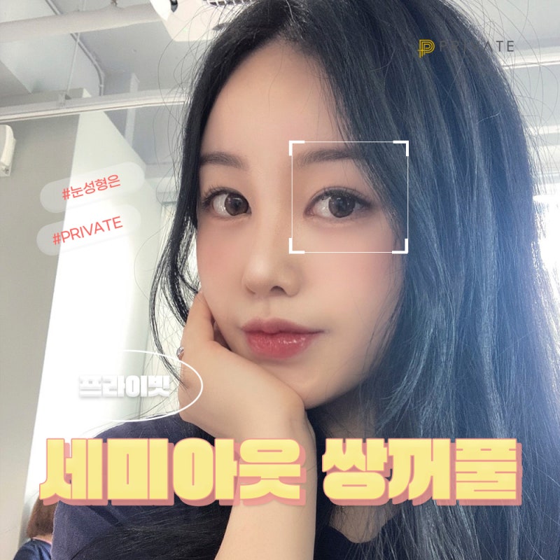 세미아웃라인 쌍꺼풀수술은 프라이빗성형외과 사진 2