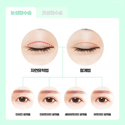 프라이빗성형외과 수험생 눈성형 코성형 알아보기 사진 4