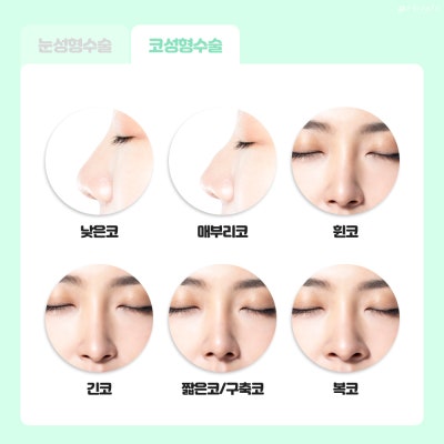 프라이빗성형외과 수험생 눈성형 코성형 알아보기 사진 5