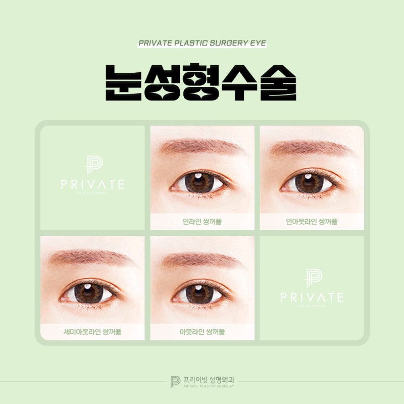 눈 쌍꺼풀 종류, 프라이빗성형외과에서 알아보자 사진 4