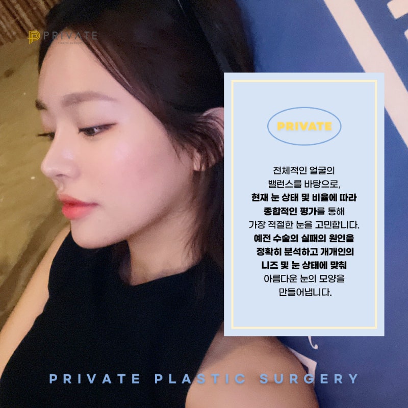 쌍수재수술후기 좋은 프라이빗성형외과