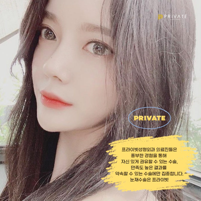 쌍수재수술후기 좋은 프라이빗성형외과 사진 7