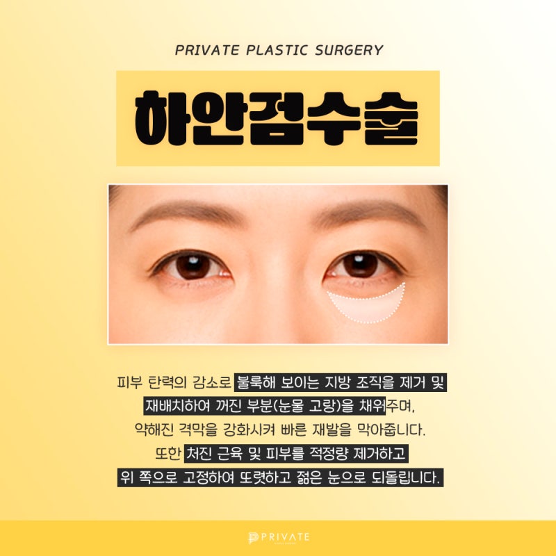 눈밑하안검수술잘하는곳은 신사 프라이빗성형외과