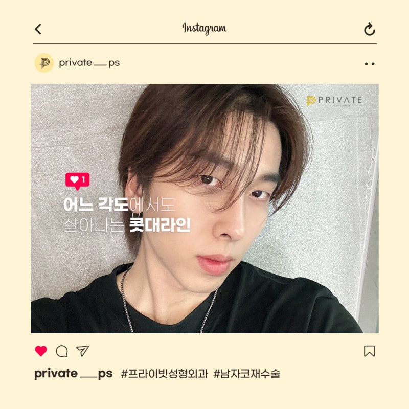 남자 코 재수술 잘하는곳은 신사역 프라이빗성형외과 사진 7