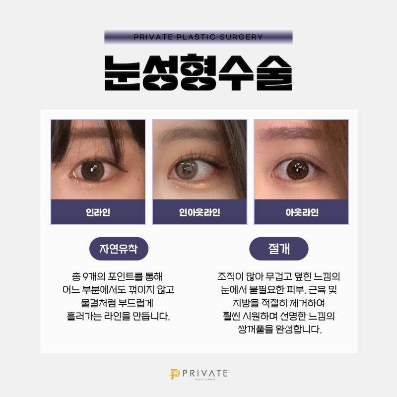 프라이빗 성형외과 쌍수후기는?