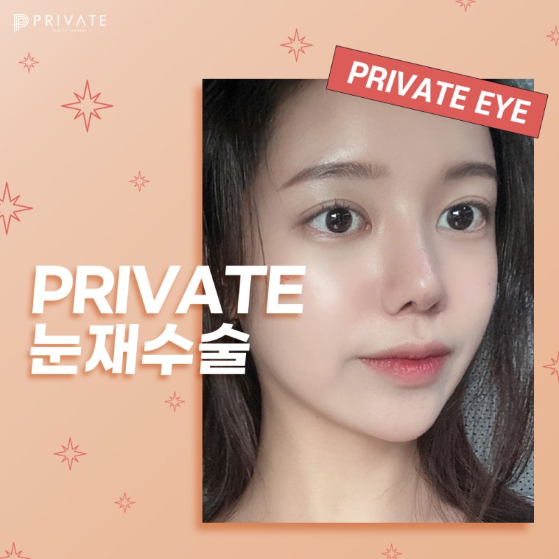 프라이빗성형외과 눈재수술 케이스