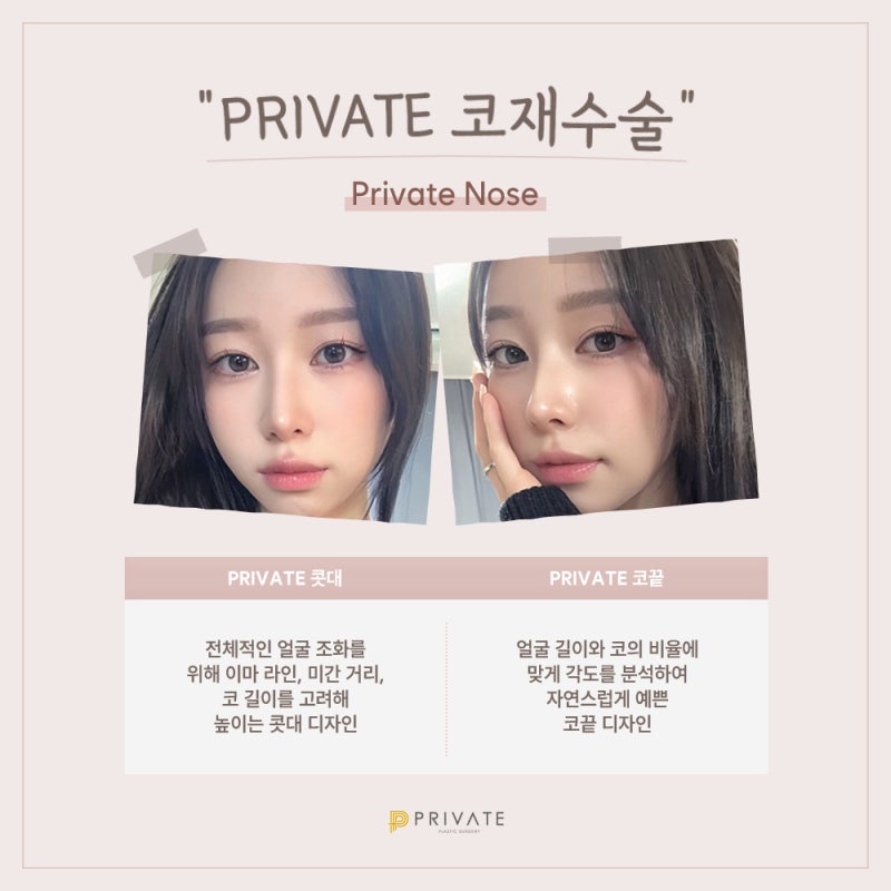 프라이빗 성형외과 코재수술 잘하는곳