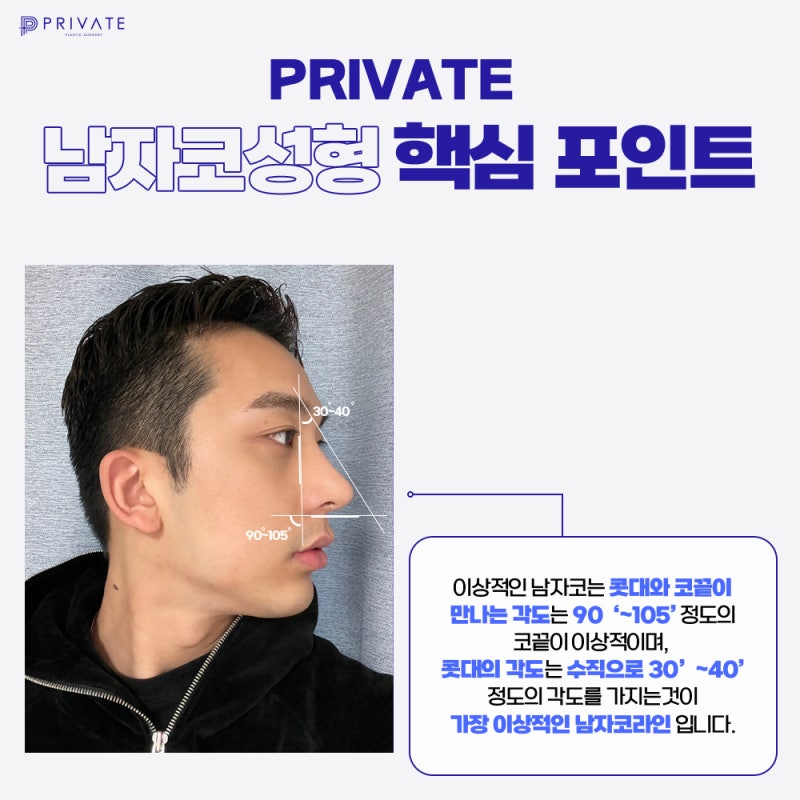 Garis Hidung Maskulin, Tempat Bedah Hidung Pria Sinsa yang Bagus 사진 5