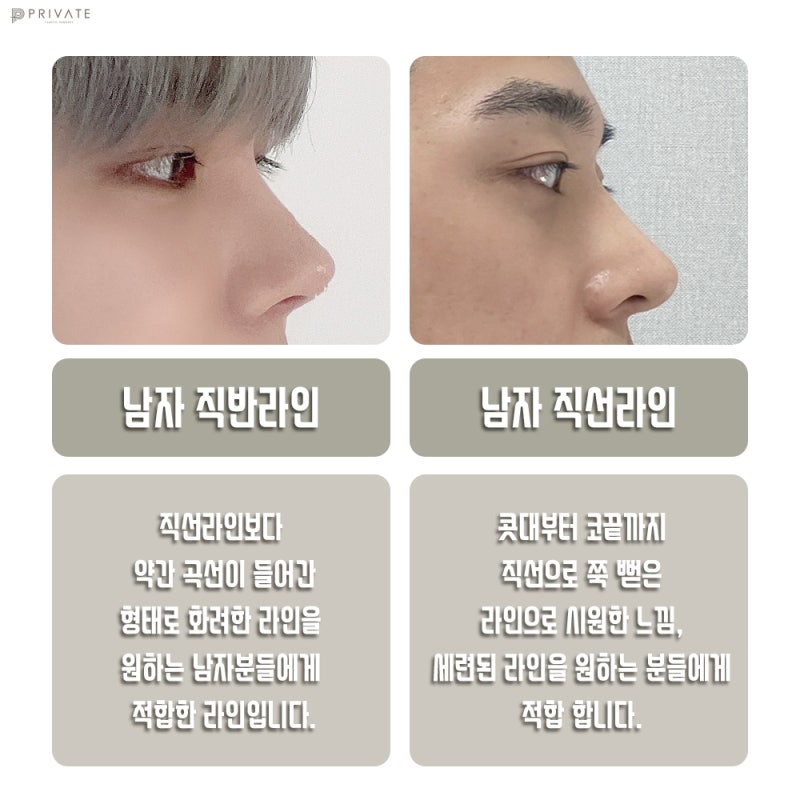 Operasi Hidung Pria Sinsa: Tampil Elegan dengan Garis Maskulin 사진 4