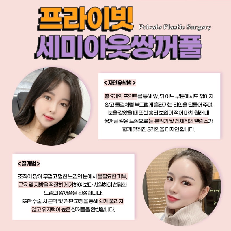 Operasi Kelopak Mata Ganda Semi-Out Line yang Cantik di Klinik Bedah Plastik Private 사진 4