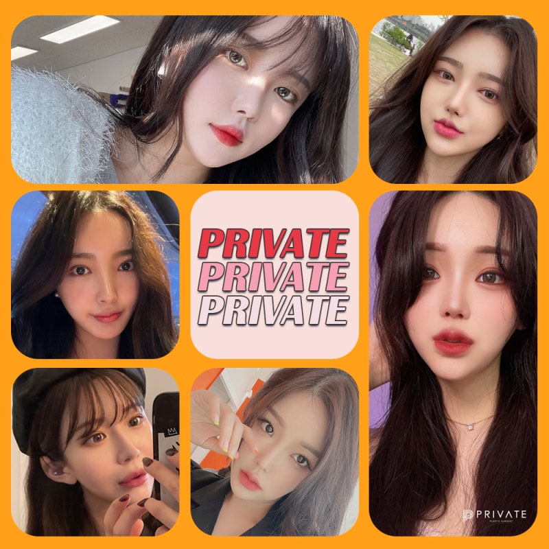 Operasi Kelopak Mata Ganda Semi-Out Line yang Cantik di Klinik Bedah Plastik Private 사진 6