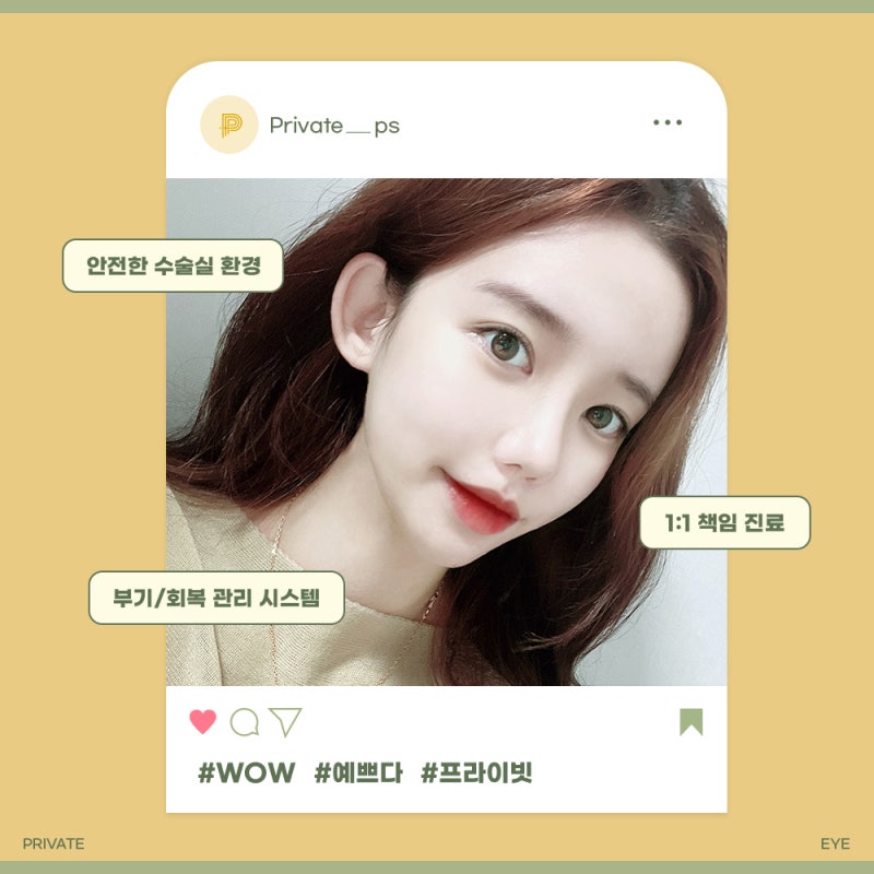 쌍꺼풀재수술잘하는곳에서 비율 맞추기 사진 6