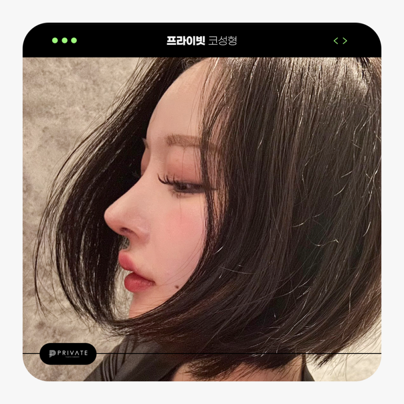 성형모델리얼모델 상시모집 프라이빗성형외과 사진 7