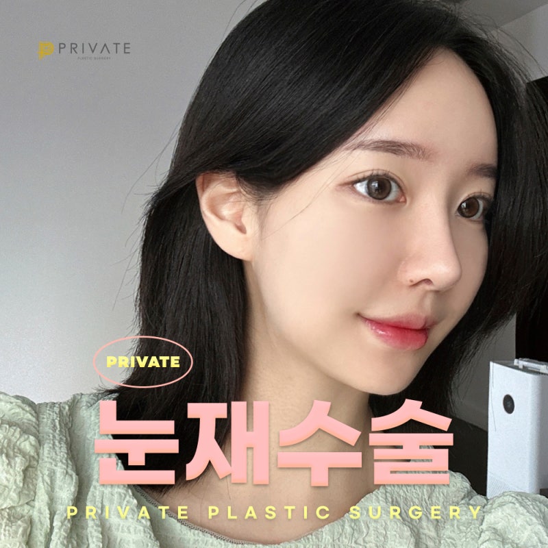 눈재수술성형후기는 프라이빗성형외과 사진 2