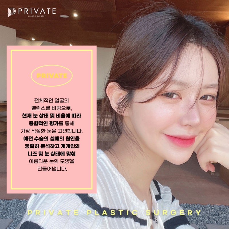 눈재수술성형후기는 프라이빗성형외과