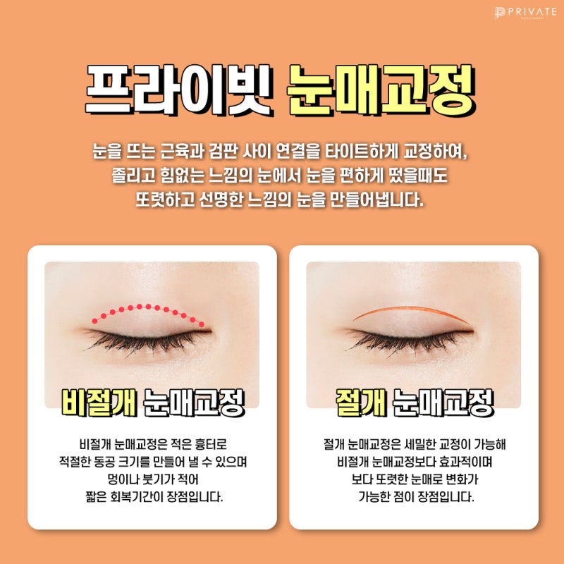 눈매교정수술유명한곳은 프라이빗성형외과