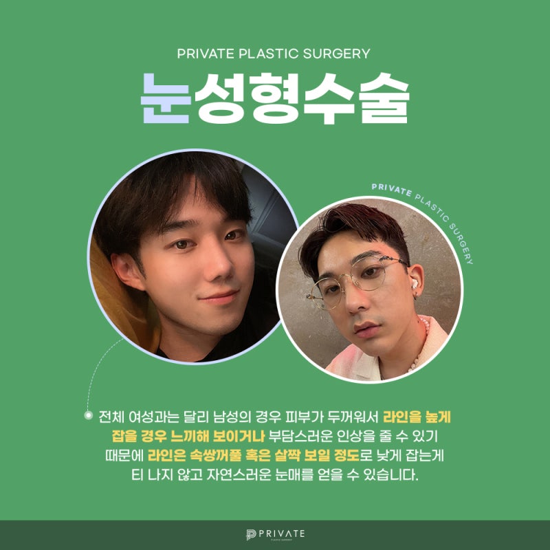 남자눈수술성형은 신사프라이빗성형외과