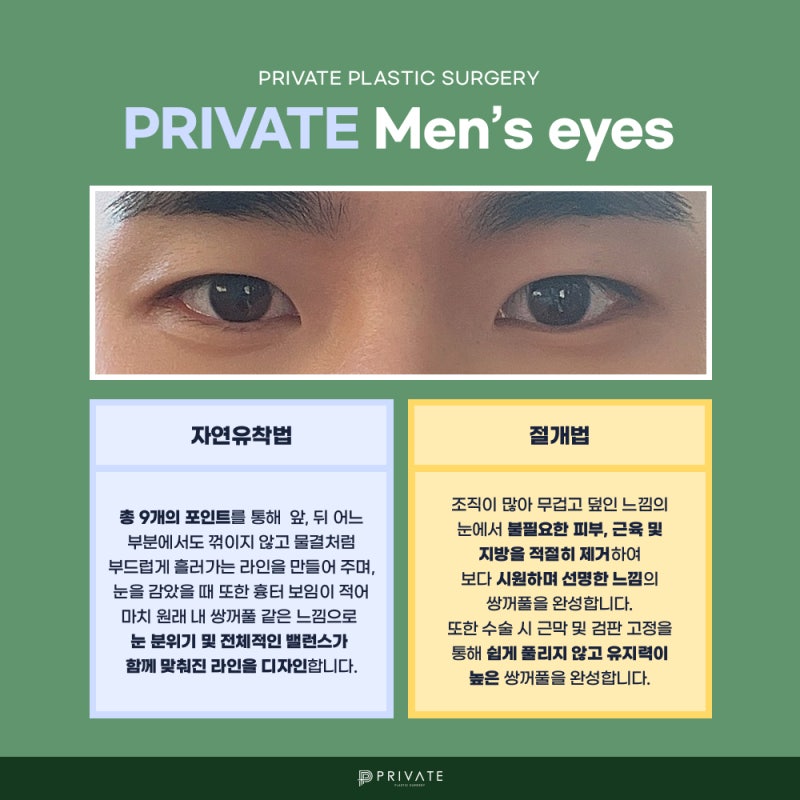 남자눈수술성형은 신사프라이빗성형외과 사진 4