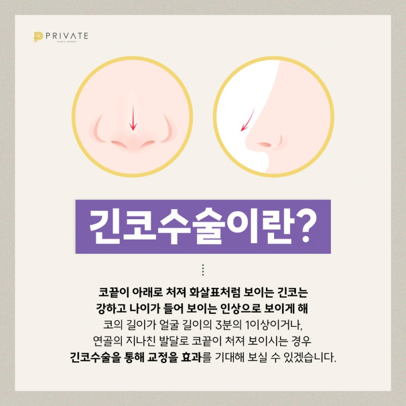 긴코성형수술후기 좋은 프라이빗성형외과 사진 3