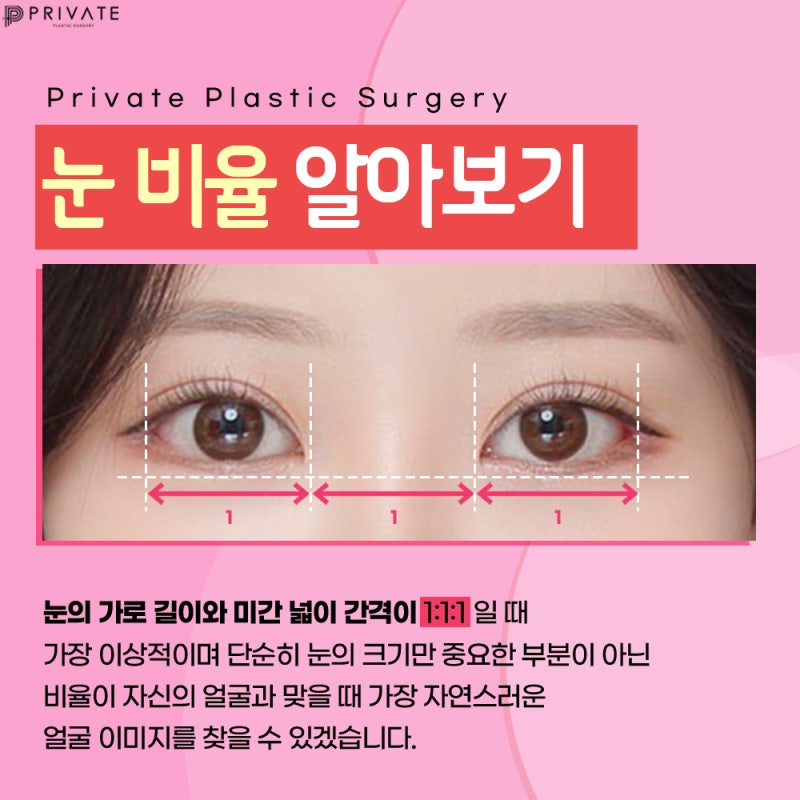 눈트임성형수술은 신사프라이빗성형외과