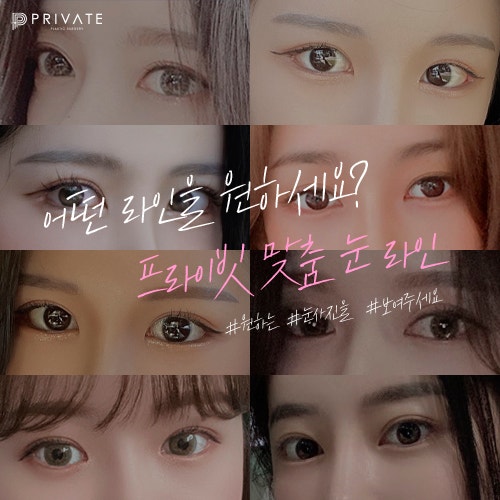 쌍수 예쁘게 잘하는 곳 프라이빗성형외과 사진 6
