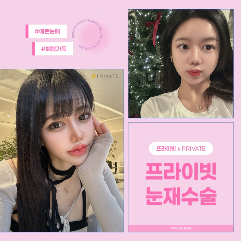 프라이빗성형외과 눈재수술 유명한곳 사진 6