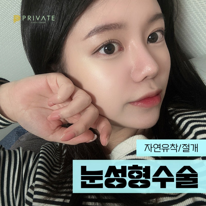 눈성형믿을수있는곳에서, 프라이빗성형외과 사진 2