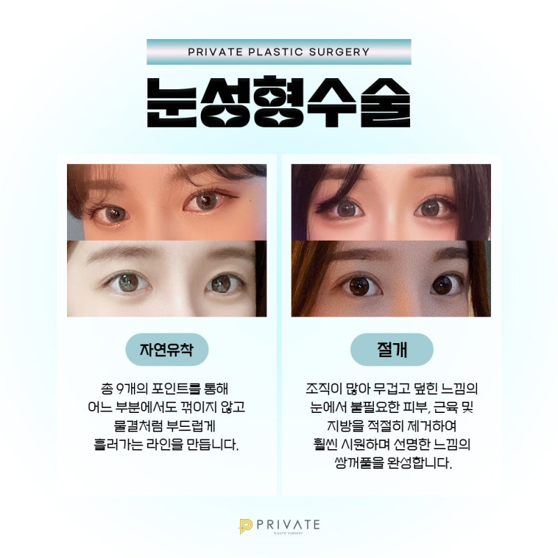 눈성형믿을수있는곳에서, 프라이빗성형외과