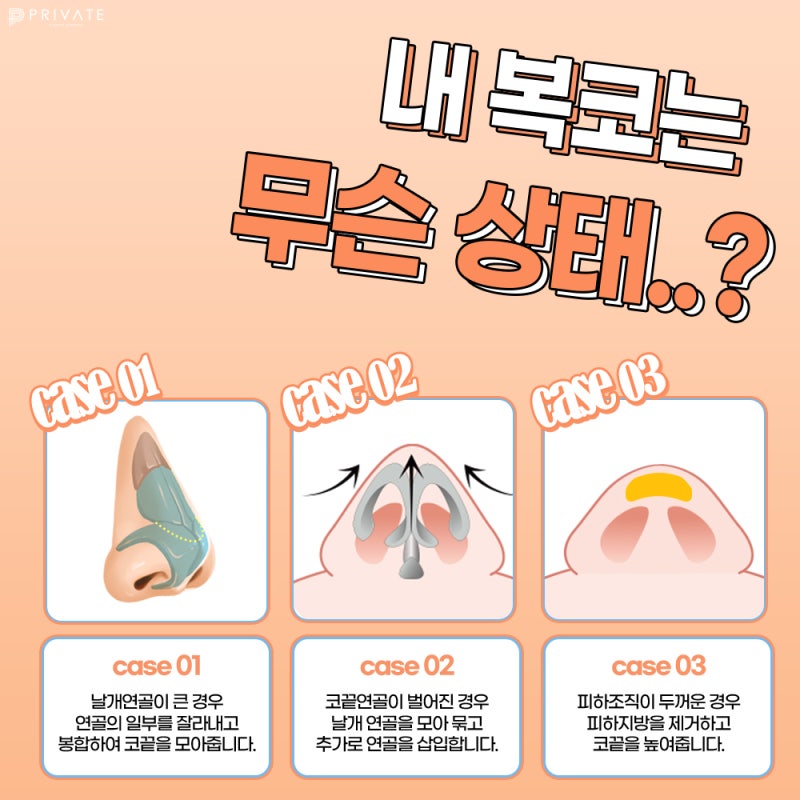 프라이빗성형외과 복코성형수술로 세련된 라인 사진 5