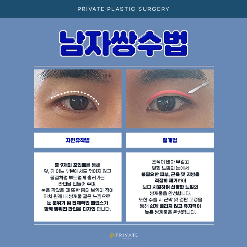 남자쌍수후기좋은곳, 프라이빗성형외과