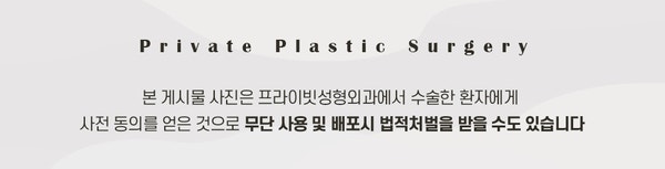 신사 눈재수술잘하는곳 프라이빗성형외과 사진 10