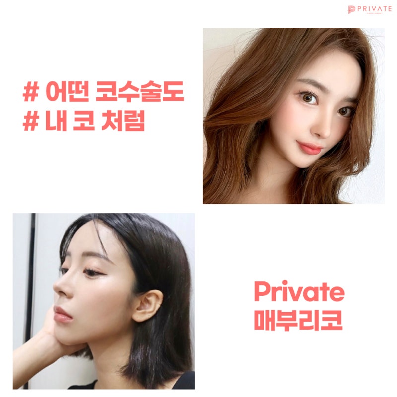 프라이빗성형외과 매부리코수술 교정으로 달라보이는 마법 사진 4