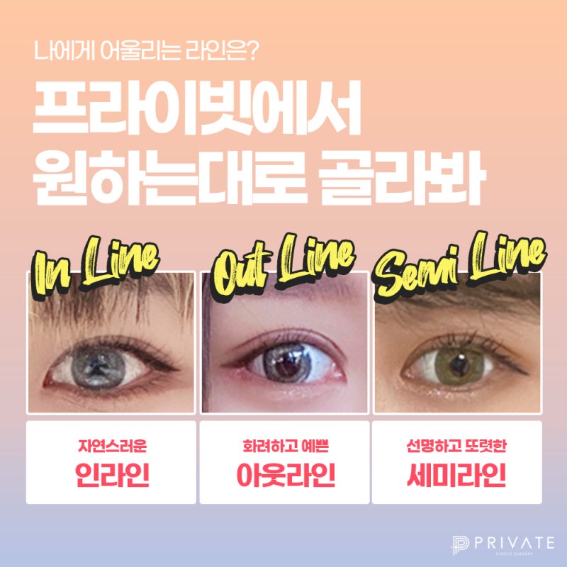 눈재수술잘하는곳 신사 프라이빗성형외과